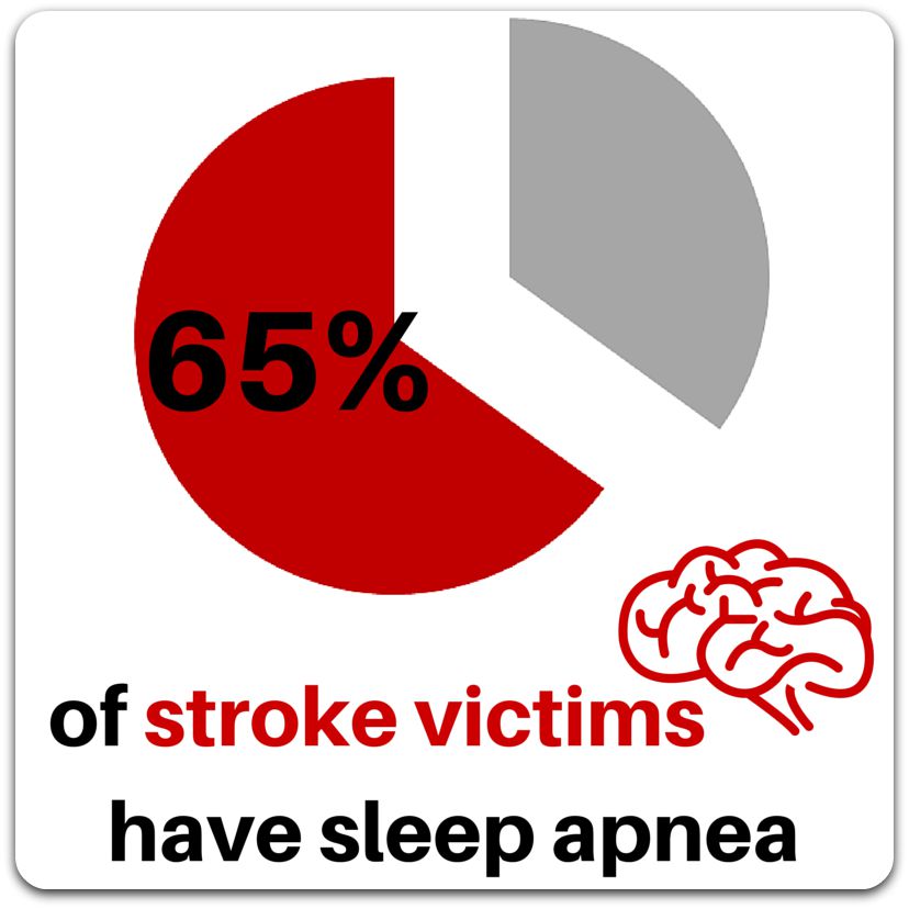 65_of_stroke_victims_have_sleep_apnea_2