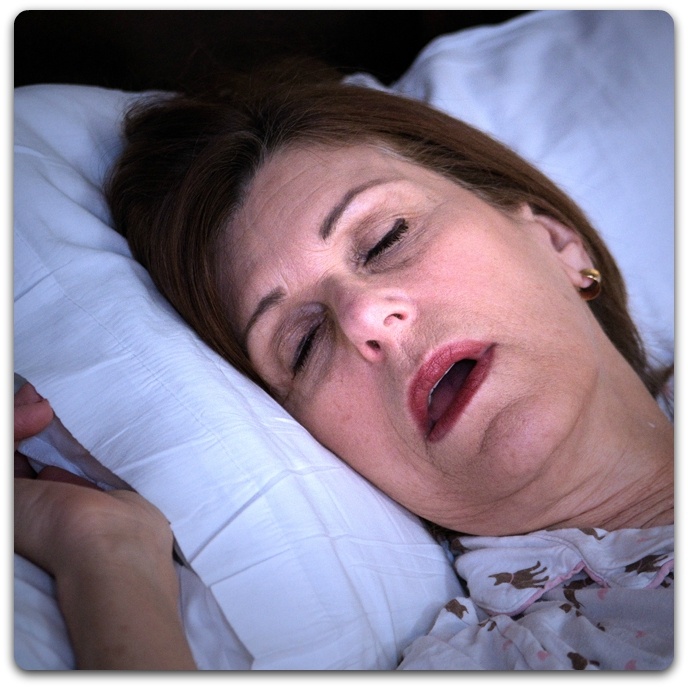 Woman with sleep apnea snoring