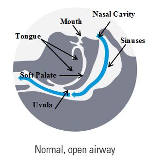 Upper airway diagram